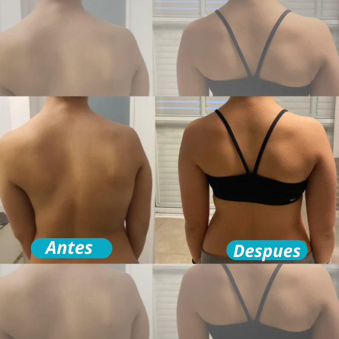 Corrector de Postura Instantáneo + Rodillo de Masaje ( Gratis )