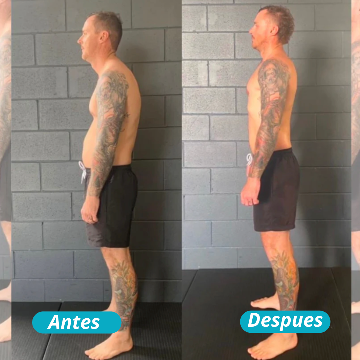 Corrector de Postura Instantáneo + Rodillo de Masaje ( Gratis )