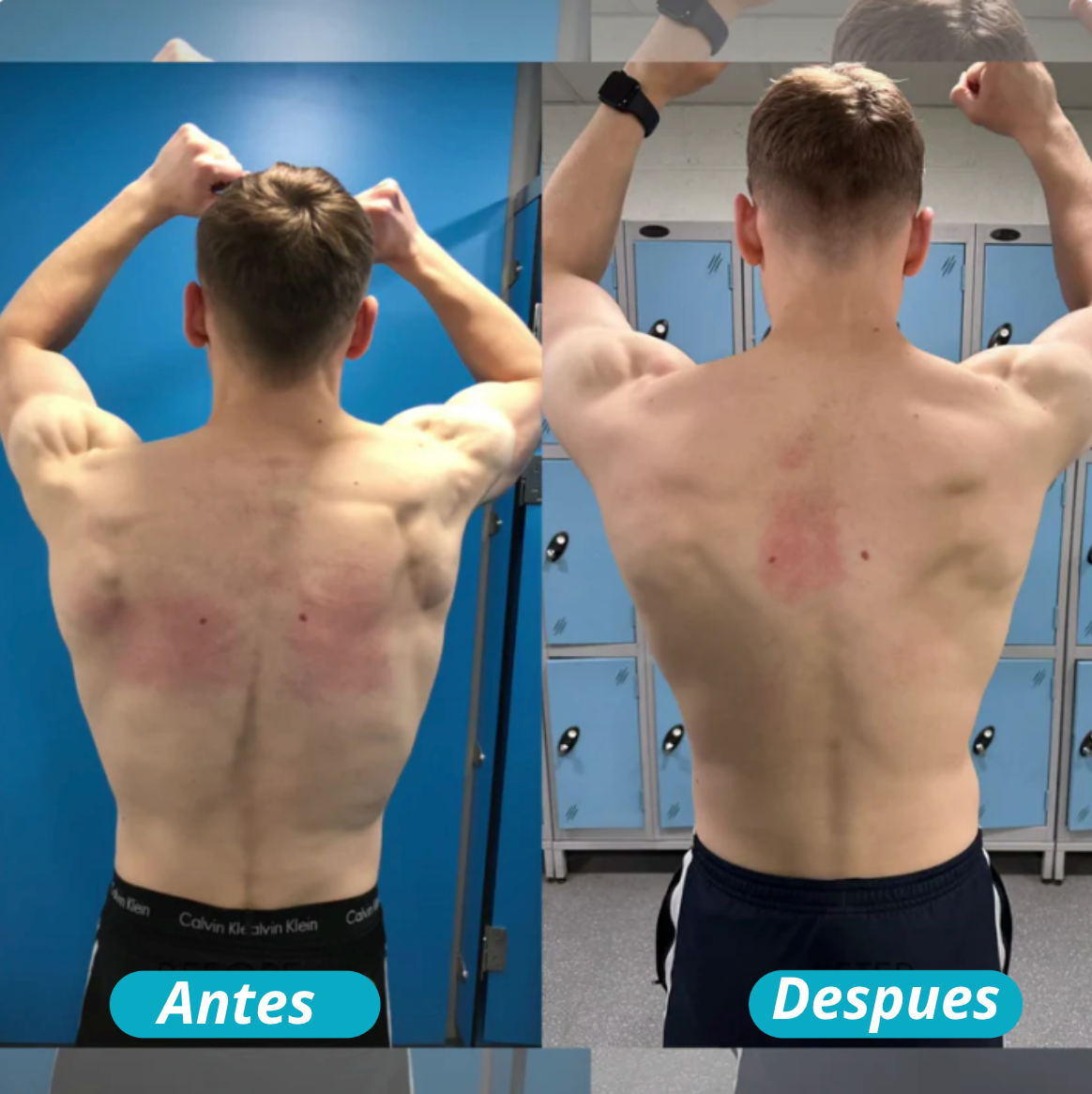 Corrector de Postura Instantáneo + Rodillo de Masaje ( Gratis )